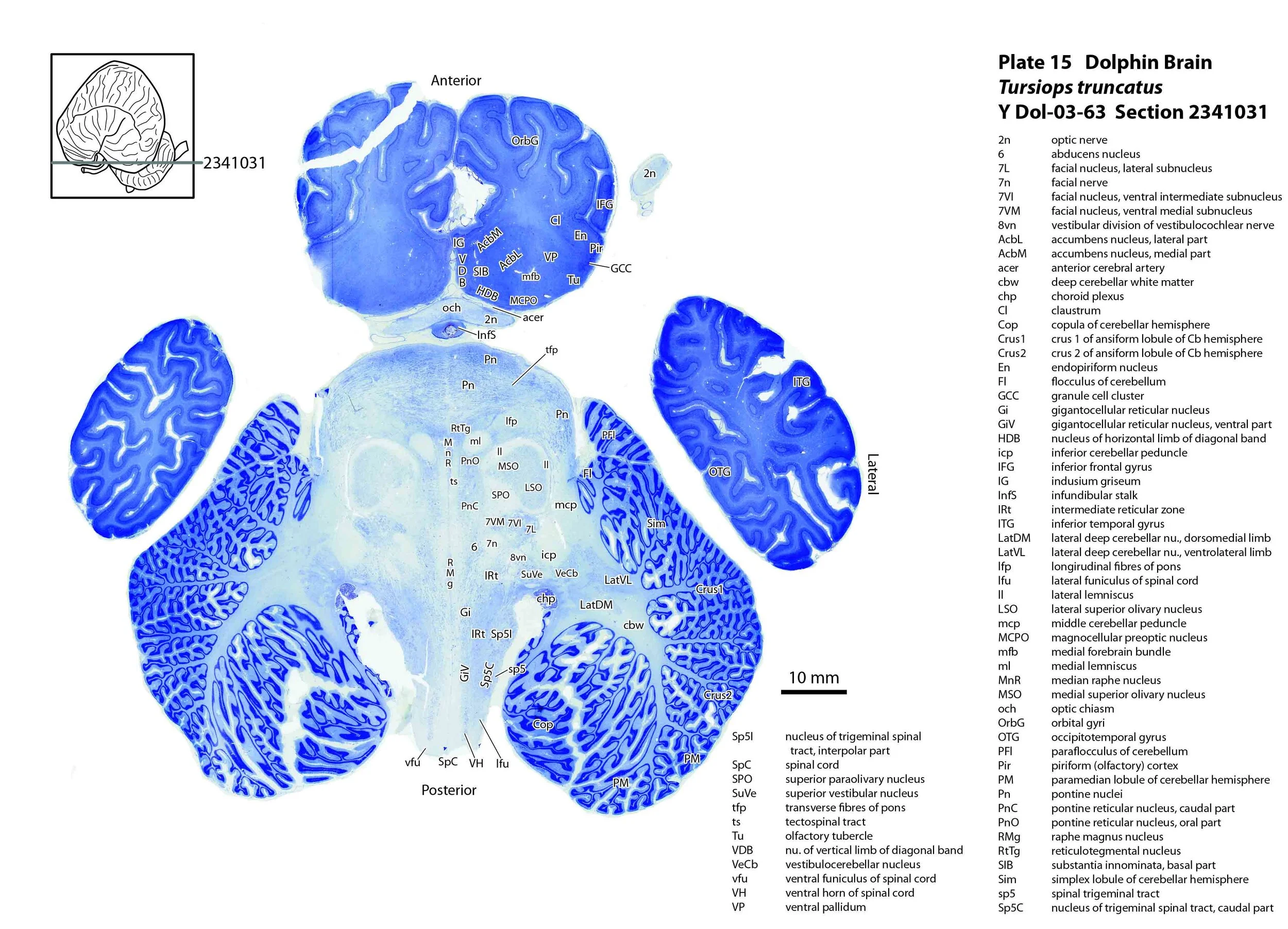 Atlas of the Brain of a Dolphin — Comparative Brain Anatomy